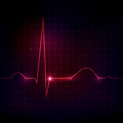 EKG mengukur detak jantung