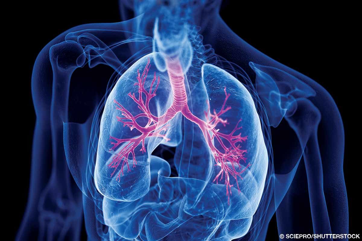 COPD in the lungs