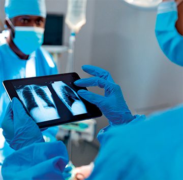 Médico mirando una radiografía de pulmón en una tableta