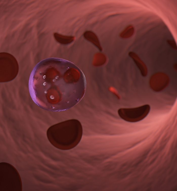 Un solo glóbulo blanco neutrófilo en la arteria con glóbulos rojos flotando a su alrededor dentro de la arteria.