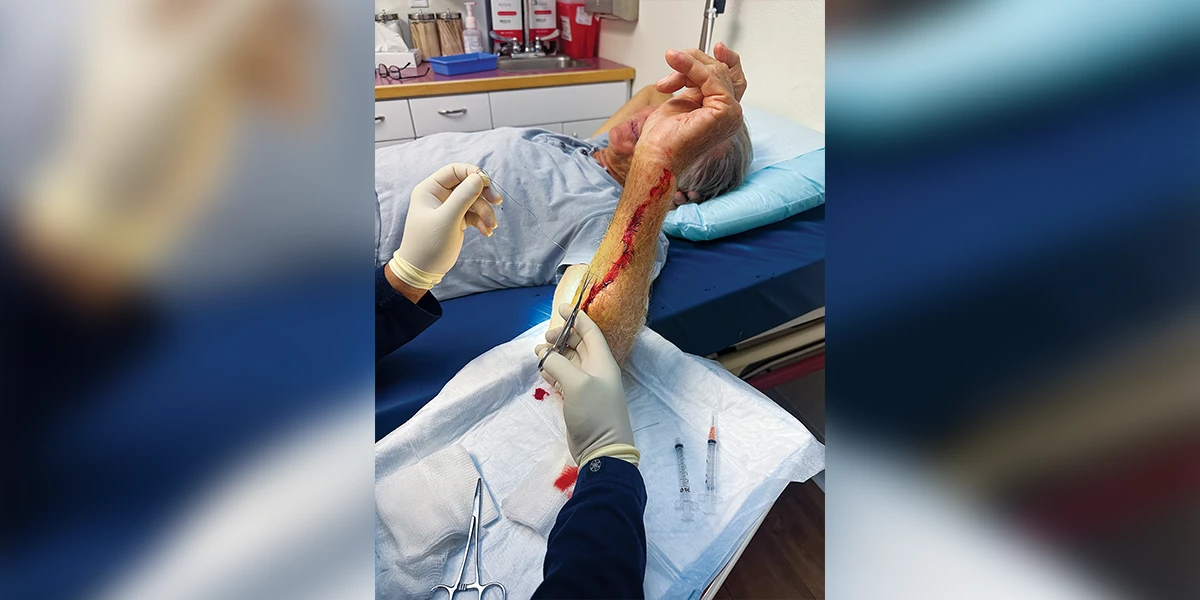 sutured wound